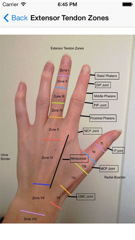 right wrist pain icd 10|Right wrist pain ICD